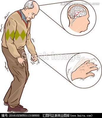“神药”再出手，最新研究提示：二甲双胍有望改善帕金森病患者的运动功能｜前沿进展